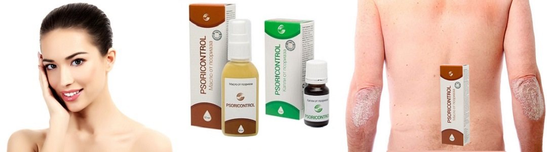 Опоясывающий лишай