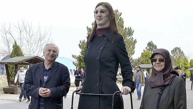 Самый высокий подросток в мире—17-летняя Румейса Гелги из Турции ...