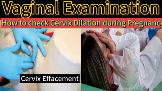 Vagina exam: 3 bin video Yandex