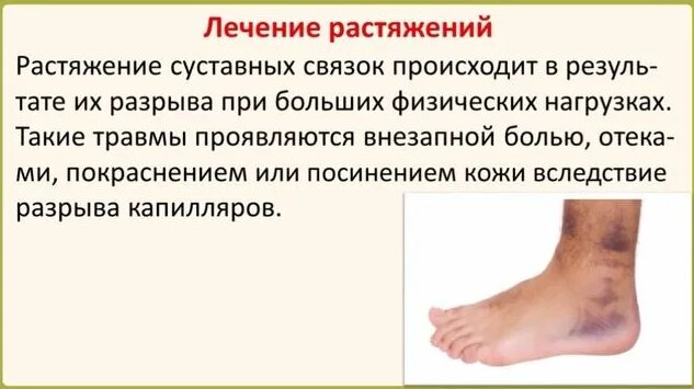 Какие мази помогают при ушибах и растяжениях? - Смотреть онлайн в ...