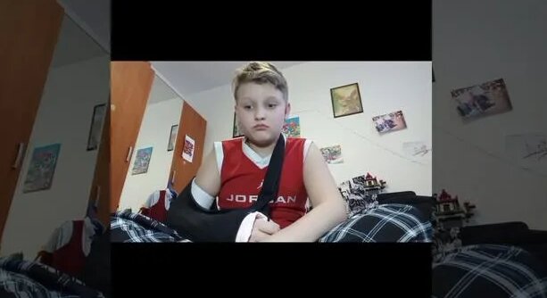 я сломал руку... - Смотреть онлайн в поиске Яндекса по Видео