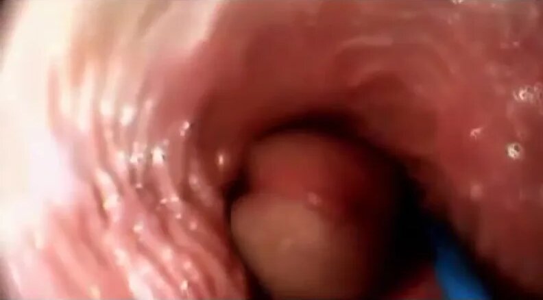 Yetuk oyoq fetishi onlayn