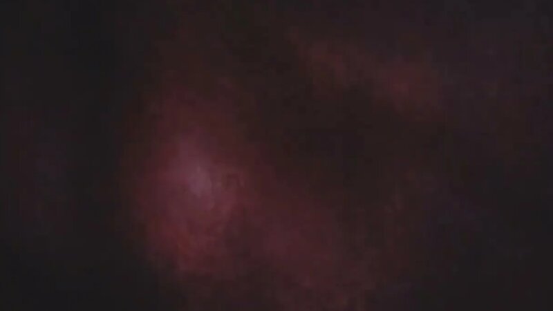 Қатерлі ісік сау есек