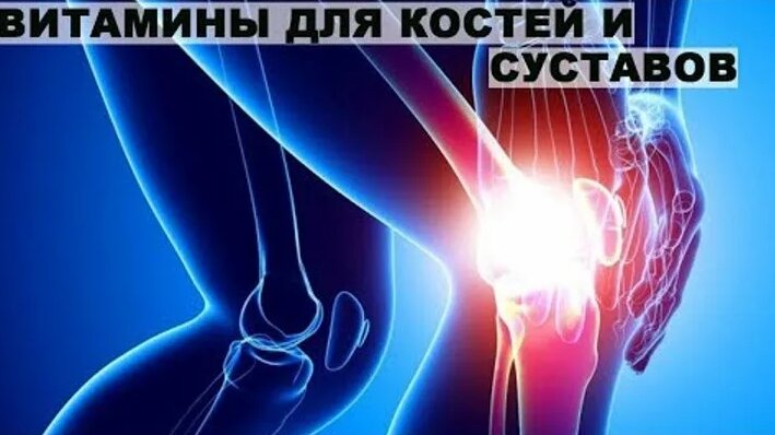 Витамины для костей и суставов.профилактика артроза. - Смотреть онлайн ...