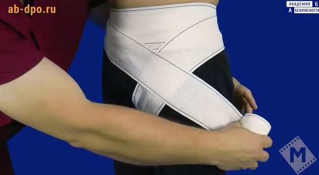 Наложение колосовидной повязки на паховую область - Смотреть онлайн в ...