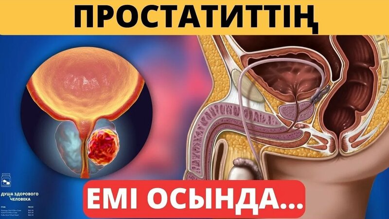 Әйелдің ішінен шыққан мүше