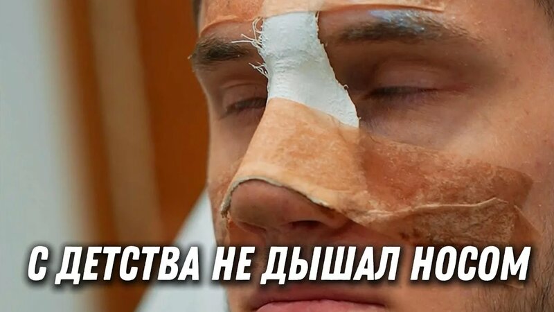 нос не дышит в горизонтальном положении