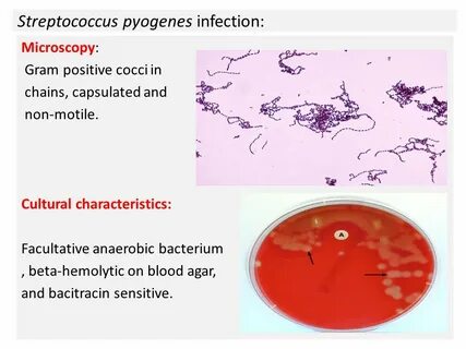 Upper respiratory tract infection: Streptococcus pyogenes. N