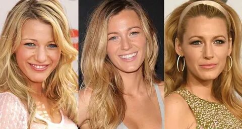 Blake Lively Plastic Surgery Before and After Pictures 2022
