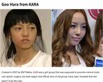 List Of Kpop Idol Plastic Surgery : Korean Idols Before And 