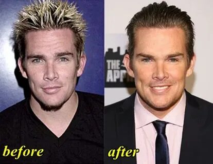 Mark McGrath Plastic Surgery Before and After - Plastic Surg