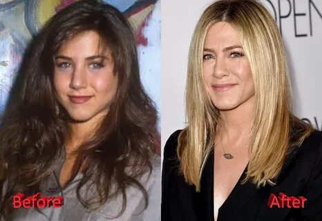 Jennifer Aniston Nose Job: Not A Secret - Celebrity Plastic 