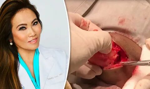 Dr Pimple Popper struggles with GRISLY apple sized cyst that