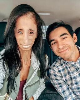 Lizzie Velasquez (@littlelizziev) — Instagram