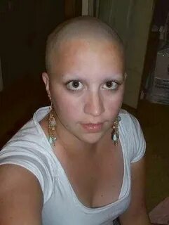 Pin on Bald women