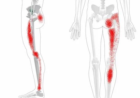 Thigh Trigger Points Groin Trigger Points (Tips + Exercises)