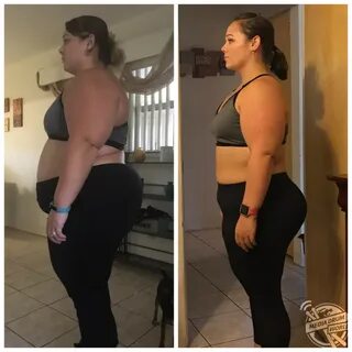 Woman Overcomes Weight Gain Caused by Endometriosis and Depr
