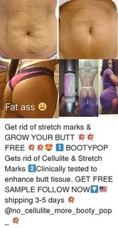 Fat Ass E Get Rid of Stretch Marks & GROW YOUR BUTT 💥 💥 FREE
