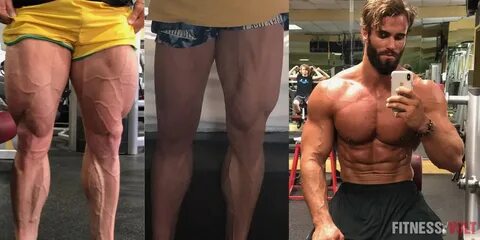 Calum Von Moger Shares Shocking Before & After Quad Tear Pic