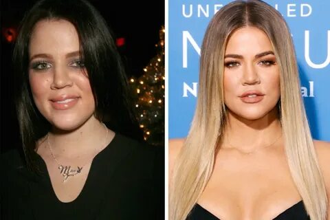 Khloe Kardashian plastic surgery: before and after transform