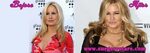 Jennifer Coolidge Plastic Surgery - Before and After Shoots