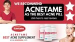 Acnetame are the best natural acne product in U.K.-Acneblitz