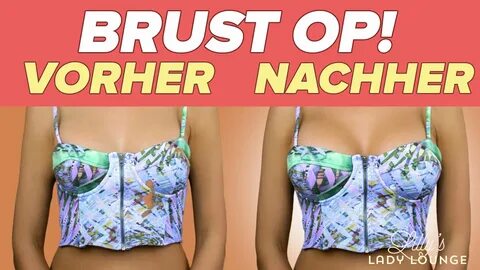 75 c brust op. ☆ MEINE BRUST-OP ☆ DANACH (Vorher-Nachher-Fotos) + KOSTEN. 