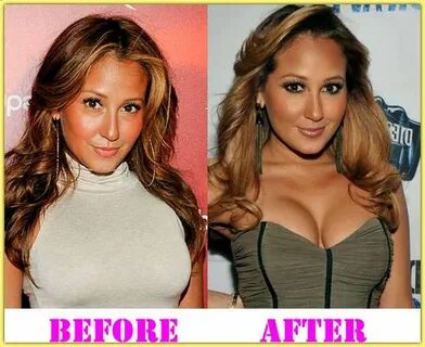 Adrienne Bailon plastic surgery before and after Adrienne Ba