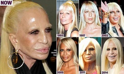 How Donatella Versace transformed herself into a human waxwo
