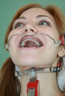 Braces Fetish Stories - Porn photos HD and porn pictures of 