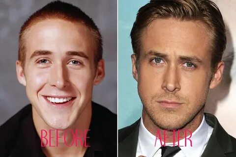 Pictures : Best Nose Jobs in Hollywood - Ryan Gosling Nose J