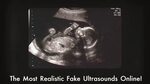 Fake Ultrasounds Online - YouTube