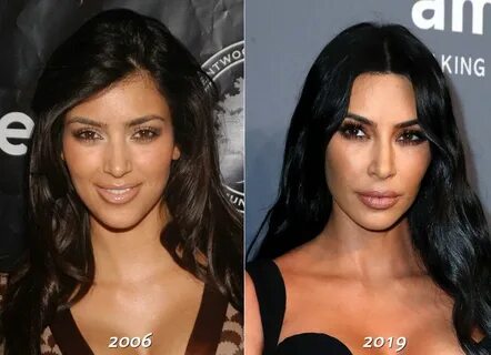 Kim Kardashian claims she’s 'never' had a nose job Nose job,