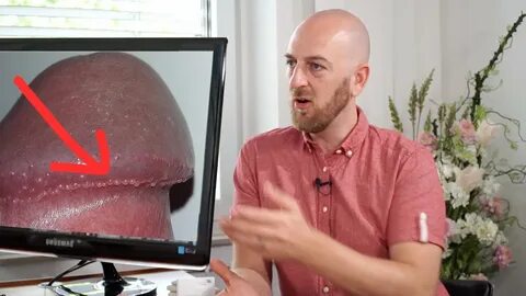 Pickel am Penis - Hornzipfel - beim Urologen - YouTube