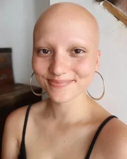 Bald Girl - SkillOfKing.Com