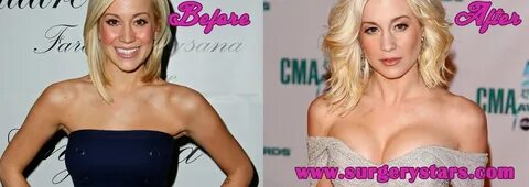 Kellie Pickler Boobs Before and After Pictures