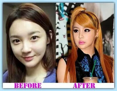 Park Bom plastic surgery, an awful procedure Park bom, Plast