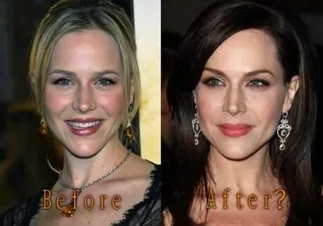Julie Benz Plastic Surgery, Before and After Botox Pictures 