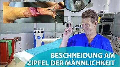 Beschneidung am Zipfel der Männlichkeit - YouTube