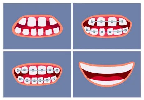 Dentist Dental Hygiene Human Teeth Cartoon - Сток картинки -