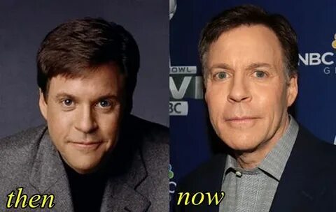 Bob Costas Plastic Surgery Before and After - Plastic Surger