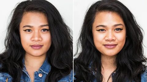 I Got a Non-Surgical Nose Job, and It Changed My Face SO Muc