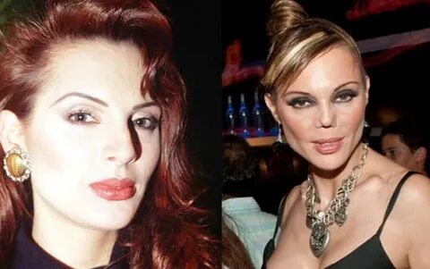 Carmen Campuzano nose job before and after - Plastic surgery