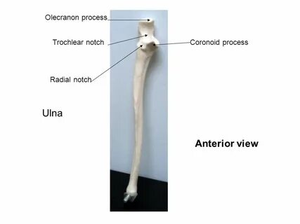 Anterior view 8. Name the Bone ppt download