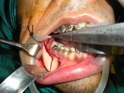 Oral And Maxillofacial Surgery In Iran Medpersia Medical Tou
