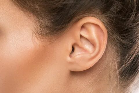 Ear Lobe Reduction Surgery - Dallas TX