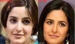 Katrina Kaif Plastic surgery before and after #after #before
