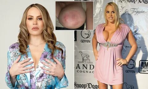 Model Who Spent 100 000 On Nine Boob Jobs Has Her Implants.