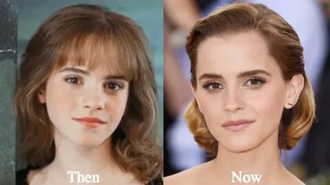 Emma Watson plastic surgery - Celebrities plastic surgery
