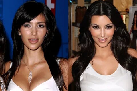 Kylie Jenner 2010 Vs 2014